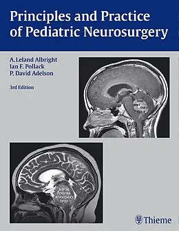 E-Book (pdf) Principles and Practice of Pediatric Neurosurgery von A. Leland Albright, Ian F. Pollack, P. David Adelson