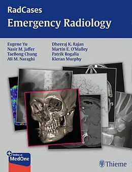 E-Book (pdf) Radcases Emergency Radiology von Eugene Yu, Nasir Jaffer, Taebong Chung