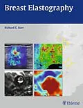 E-Book (pdf) Breast Elastography von Richard G. Barr