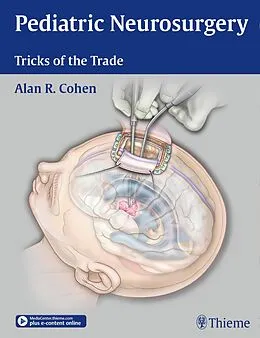 E-Book (pdf) Pediatric Neurosurgery: Tricks of the Trade von Alan R. Cohen