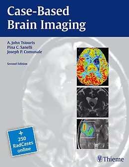 E-Book (pdf) Case-Based Brain Imaging von A. John Tsiouris, Pina C. Sanelli, Joseph Comunale