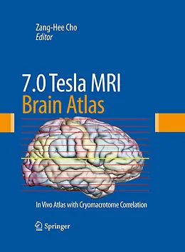 E-Book (pdf) 7.0 Tesla MRI Brain Atlas von Zang-Hee Cho