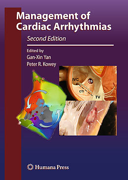 Livre Relié Management of Cardiac Arrhythmias de 