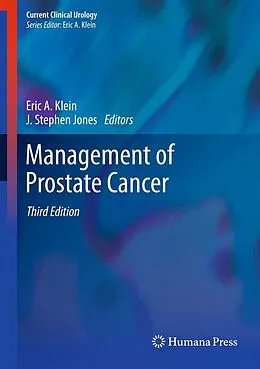 E-Book (pdf) Management of Prostate Cancer von Eric A. Klein, J. Stephen Jones
