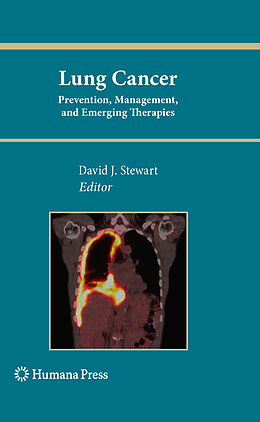 E-Book (pdf) Lung Cancer: von David J. Stewart