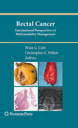 E-Book (pdf) Rectal Cancer von Brian G. Czito, Christopher G. Willett