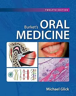 E-Book (epub) Burket's Oral Medicine, 12e von Michael Glick