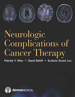 E-Book (epub) Neurologic Complications of Cancer Therapy von Eudocia Quant Lee, David Schiff, Patrick Y. Wen
