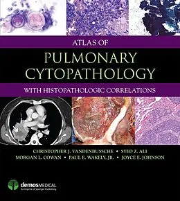 E-Book (epub) Atlas of Pulmonary Cytopathology von Christopher J. Vandenbussche, Syed Z. Ali, Morgan Cowan