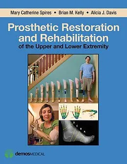 E-Book (epub) Prosthetic Restoration and Rehabilitation of the Upper and Lower Extremity von Alicia J. Davis, Brian M. Kelly, Mary Catherine Spires