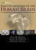 E-Book (epub) Imaging Anatomy of the Human Brain von Neil M. Borden, Scott E. Forseen, Cristian Stefan