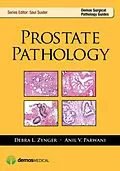 E-Book (epub) Prostate Pathology von Anil V. Parwani, Debra Zynger