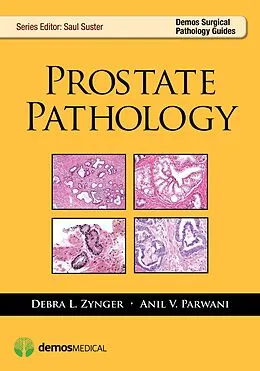 E-Book (epub) Prostate Pathology von Anil V. Parwani, Debra Zynger