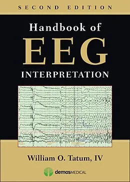 E-Book (epub) Handbook of EEG Interpretation, Second Edition von William O. Tatum