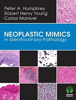 E-Book (epub) Neoplastic Mimics in Genitourinary Pathology von Peter A. Humphrey, J. Carlos Manivel, Robert H. Young