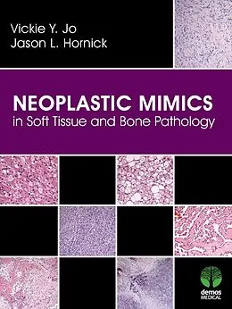 E-Book (epub) Neoplastic Mimics in Soft Tissue and Bone Pathology von Vickie Y. Jo, Jason L. Hornick