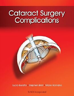 Fester Einband Cataract Surgery Complications von Lucio Buratto, Stephen F. Brint, Mario R. Romano