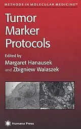 Kartonierter Einband Tumor Marker Protocols von Margaret Hanausek