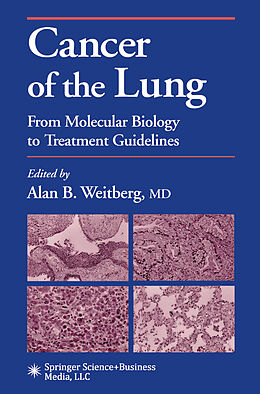 Kartonierter Einband Cancer of the Lung von 
