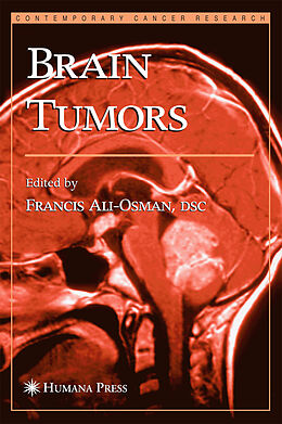 Kartonierter Einband Brain Tumors von 