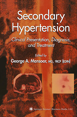 Kartonierter Einband Secondary Hypertension von 
