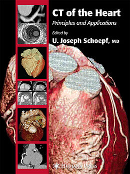Couverture cartonnée CT of the Heart de 