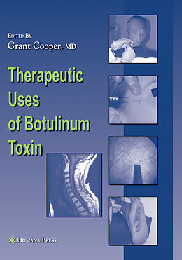 Couverture cartonnée Therapeutic Uses of Botulinum Toxin de 