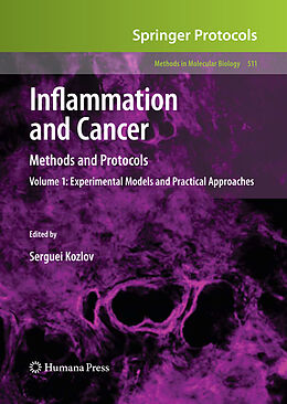 Kartonierter Einband Inflammation and Cancer von 