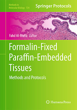 Fester Einband Formalin-Fixed Paraffin-Embedded Tissues von 