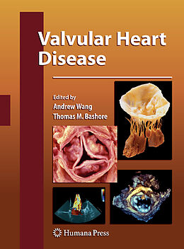 Couverture cartonnée Valvular Heart Disease de 