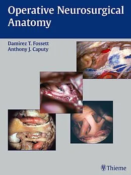 PDF Operative Neurosurgical Anatomy von Damirez T. Fossett, Anthony J. Caputy