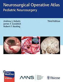 E-Book (pdf) Neurosurgical Operative Atlas: Pediatric Neurosurgery von 