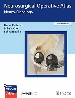 E-Book (pdf) Neurosurgical Operative Atlas: Neuro-Oncology von 