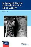 E-Book (pdf) Instrumentation for Minimally Invasive Spine Surgery von Kern Singh