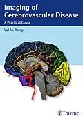 E-Book (pdf) Imaging of Cerebrovascular Disease von Val M. Runge