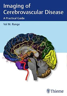 E-Book (pdf) Imaging of Cerebrovascular Disease von Val M. Runge