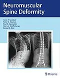 E-Book (pdf) Neuromuscular Spine Deformity von 