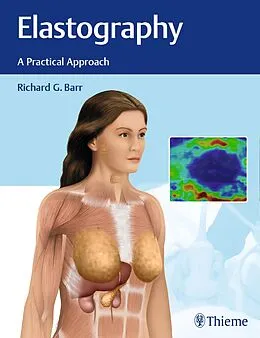 E-Book (pdf) Elastography von Richard G. Barr