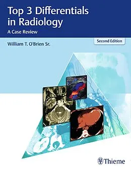 E-Book (pdf) Top 3 Differentials in Radiology von William T. O'Brien