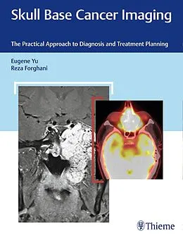 E-Book (pdf) Skull Base Cancer Imaging von Eugene Yu, Reza Forghani