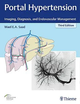 E-Book (pdf) Portal Hypertension von Wael E. A. Saad