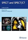 E-Book (pdf) SPECT and SPECT/CT von Chun Kim, Katherine Zukotynski
