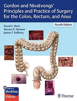 E-Book (pdf) Gordon and Nivatvongs' Principles and Practice of Surgery for the Colon, Rectum, and Anus von David E. Beck, Steven D. Wexner, Janice F. Rafferty