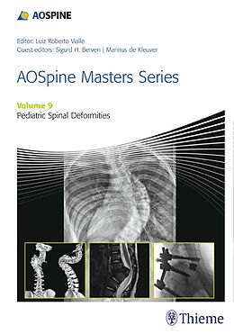 E-Book (pdf) AOSpine Masters Series, Volume 9: Pediatric Spinal Deformities von 