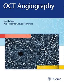 E-Book (pdf) OCT Angiography von David Chow