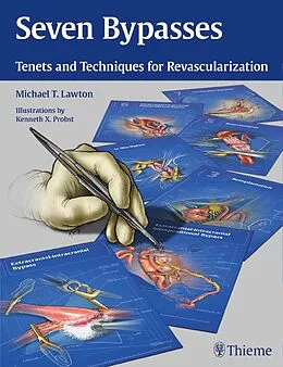 E-Book (pdf) Seven Bypasses von Michael T. Lawton