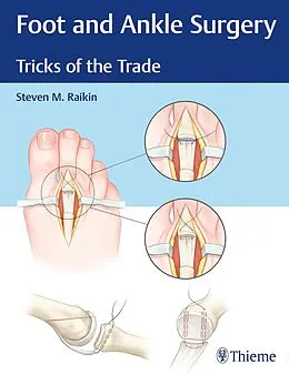 E-Book (pdf) Foot and Ankle Surgery von Steven M. Raikin