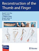  Reconstruction of the Thumb and Finger de David Chiu, Guy Foucher, J William et al Littler