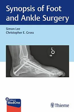 E-Book (pdf) Synopsis of Foot and Ankle Surgery von Simon Lee, Christopher Gross