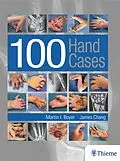 E-Book (pdf) 100 Hand Cases von Martin Boyer, James Chang
